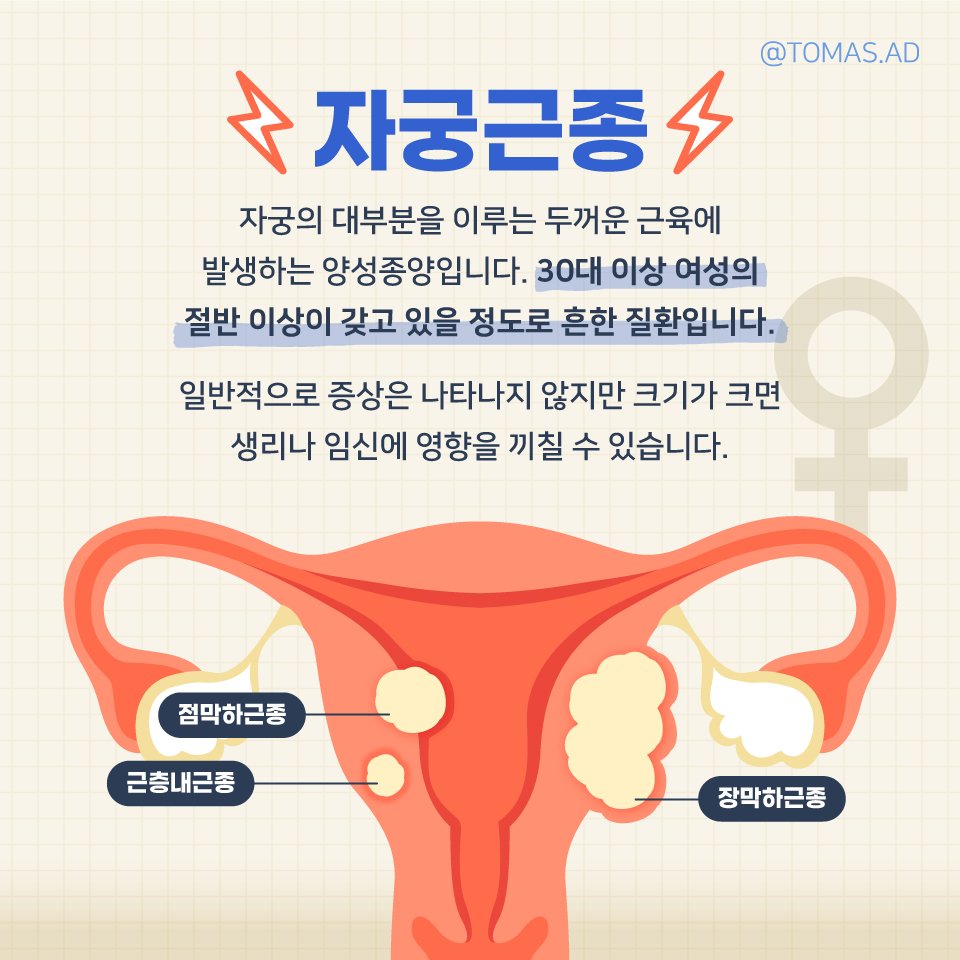 자궁근종 치료 방법 및 예방