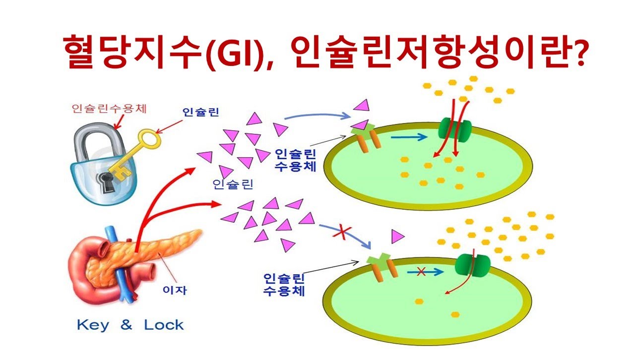 탄수화물 과잉 섭취의 위험성