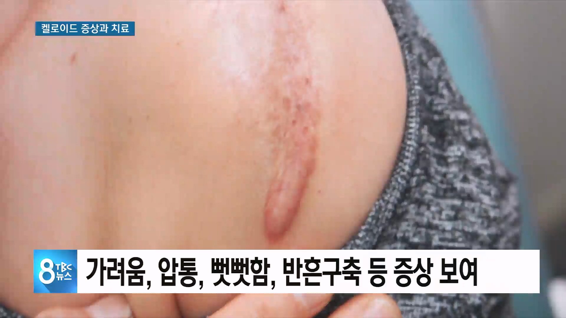 환자들에게 전하는 희망의 메시지