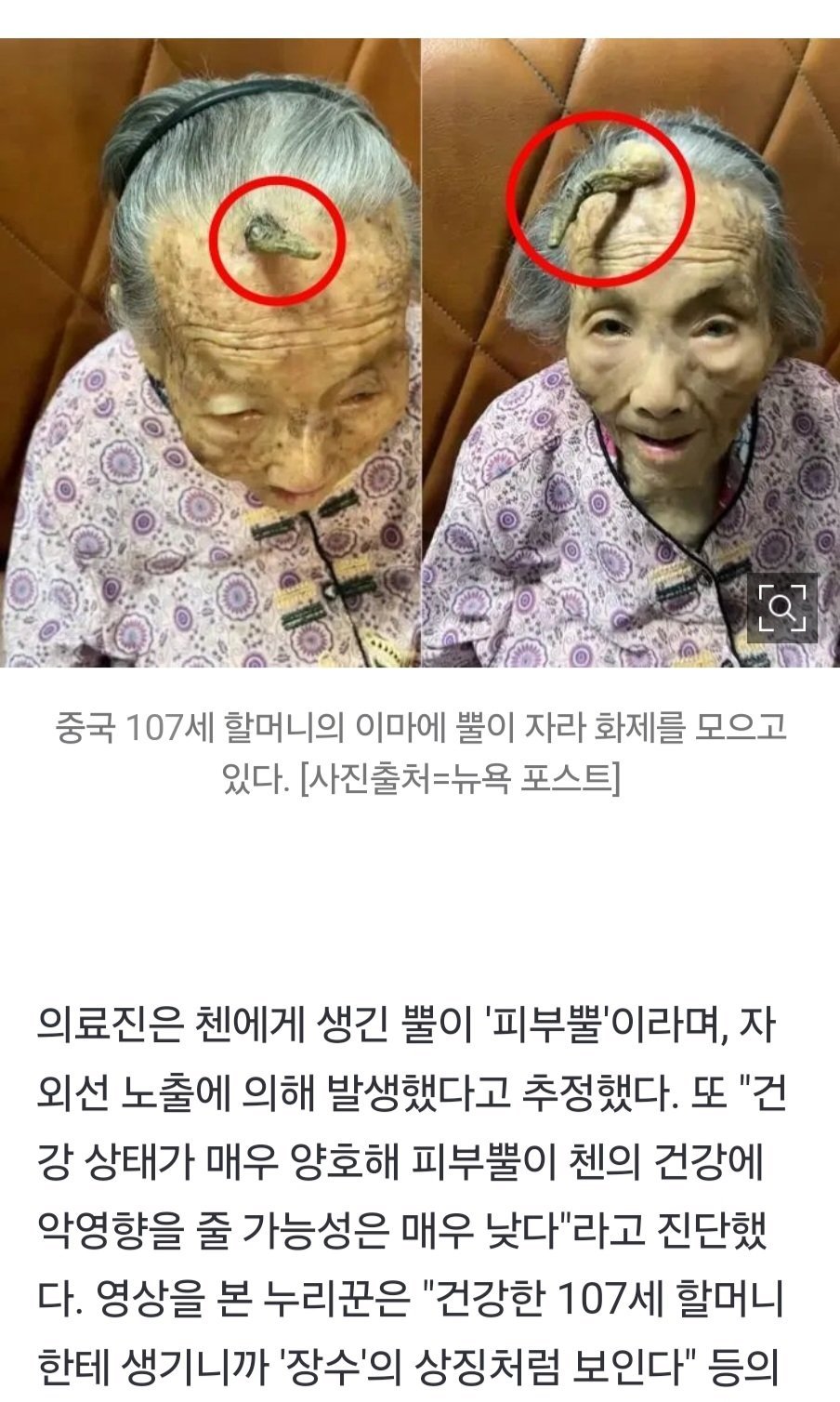 자외선과 피부 건강의 관계